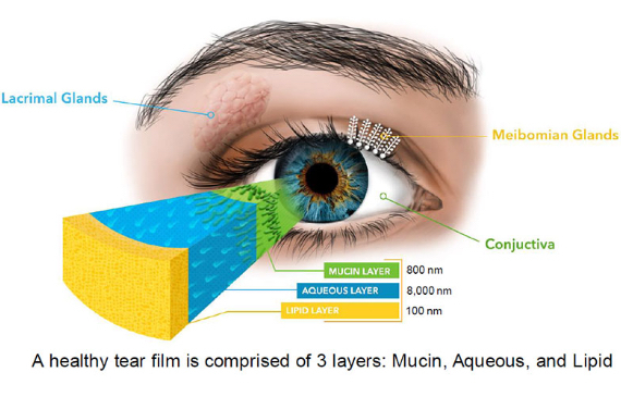 Dry Eye Diagram